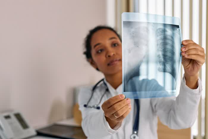 A doctor looking at a chest X-ray